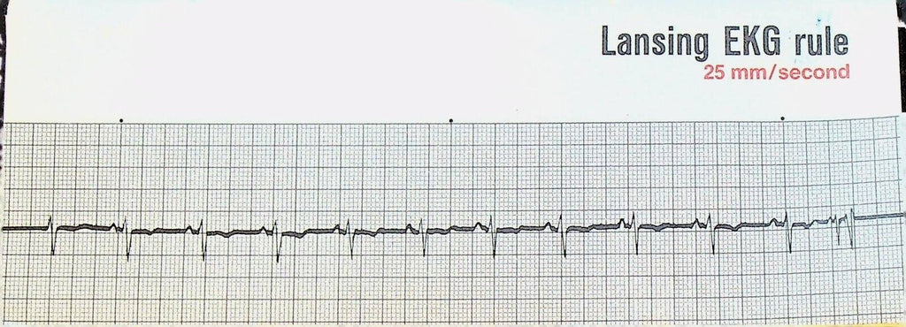 Lansing EKG Rule Upjohn 1970 in Envelope